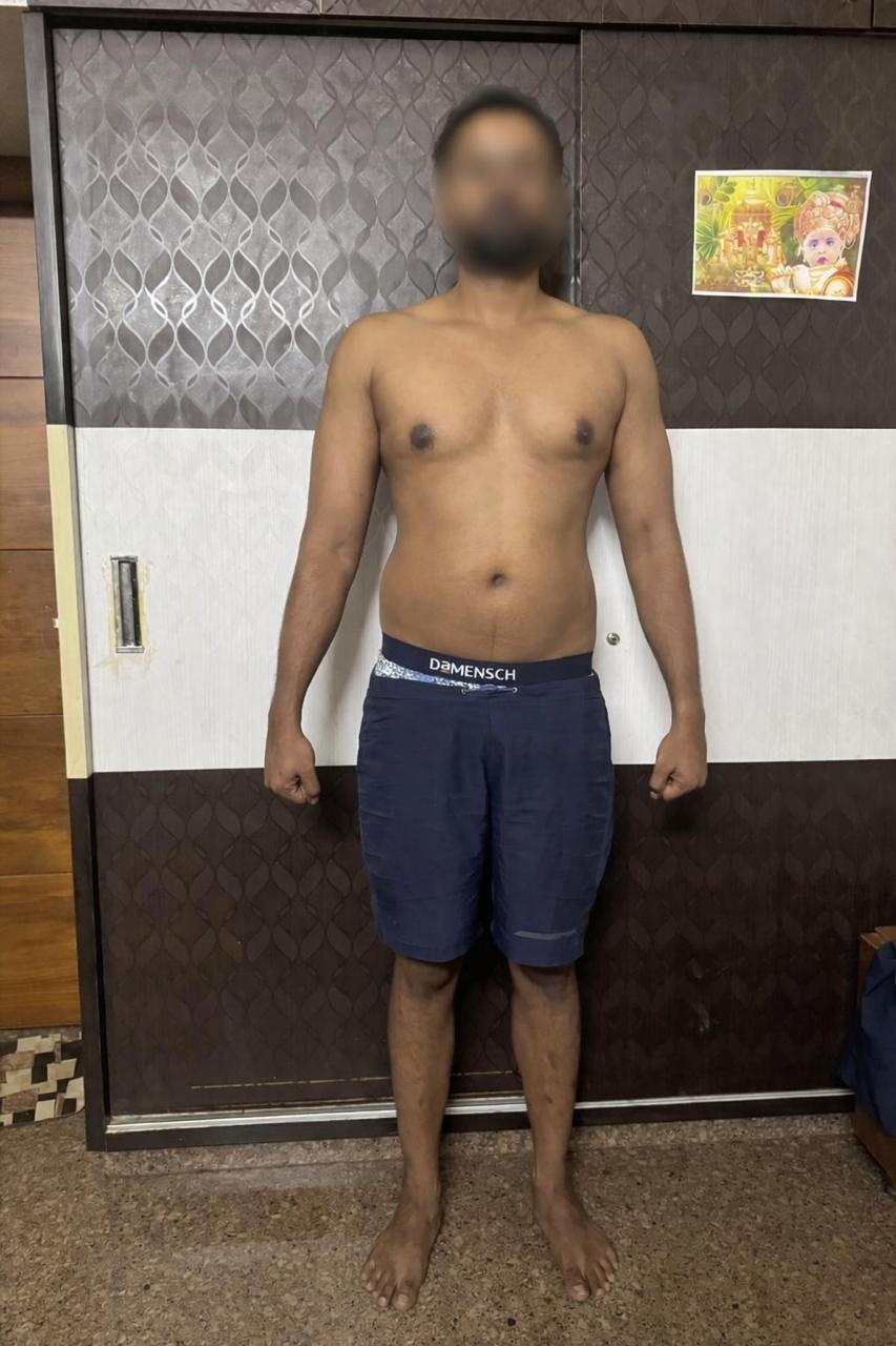 Before Transformation